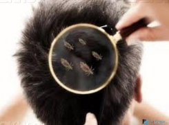 В Воронежской области за полгода 230 человек переболели вшивостью