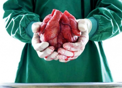 Правительство разработало законопроект, предлагающий россиянам дарить собственные органы