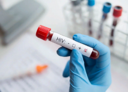 В 2020 году в Воронежской области выявили ВИЧ у 383 человек