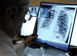 В Борисоглебской районной больнице обещают решить проблему с флюорографическим кабинетом  