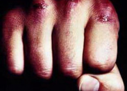 Нетрезвый житель Борисоглебска забил собутыльника до смерти