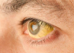 В Воронежской области зафиксировали снижение заболеваемости вирусным гепатитом В и С