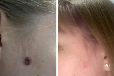 Врач-косметолог, врач-дерматовенеролог (высшая категория) - Кудренко Татьяна Николаевна - 