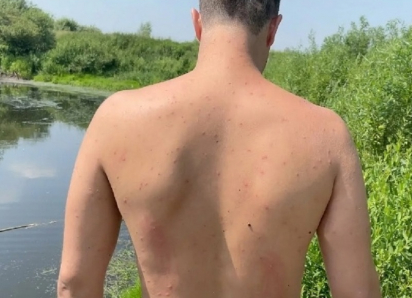 О неприятных последствиях купания в теплых водоемах со стоячей водой предупредили жителей Воронежской области