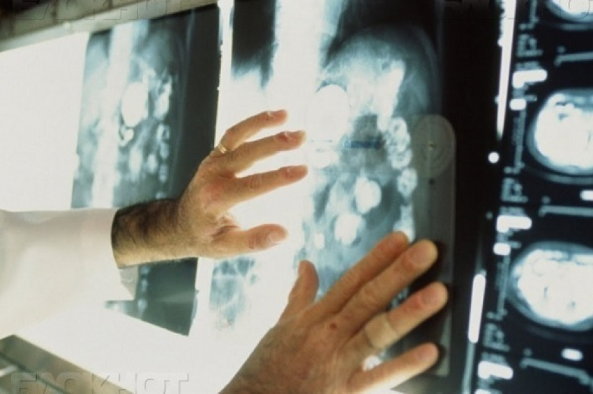 В Воронежской области выявлено 65 тыс. человек, больных раком